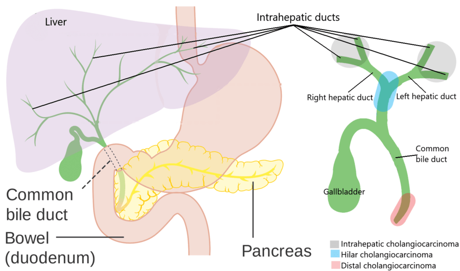 Bile duct anatomy, bile duct cancer, cholangiocarcinoma