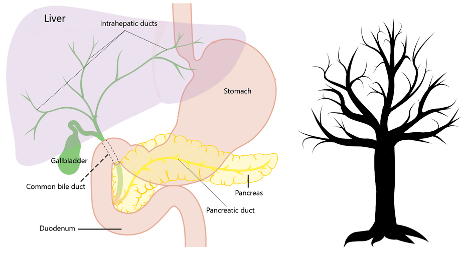 Bile duct anatomy, bile duct cancer, cholangiocarcinoma