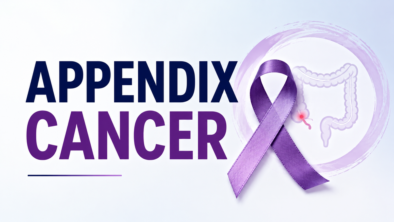 Appendix cancer overview — symptoms, types, diagnosis, CRS, HIPEC and specialist care