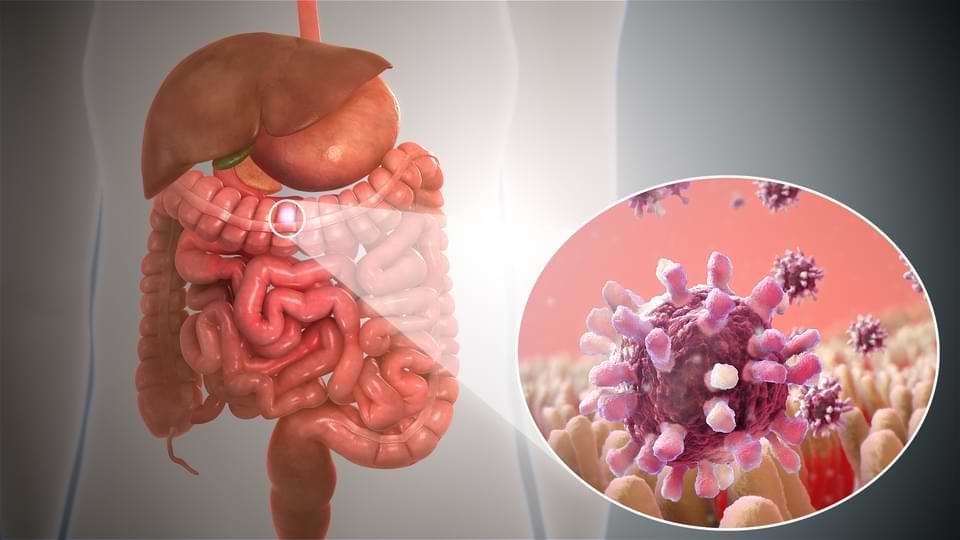 Digestive cancers