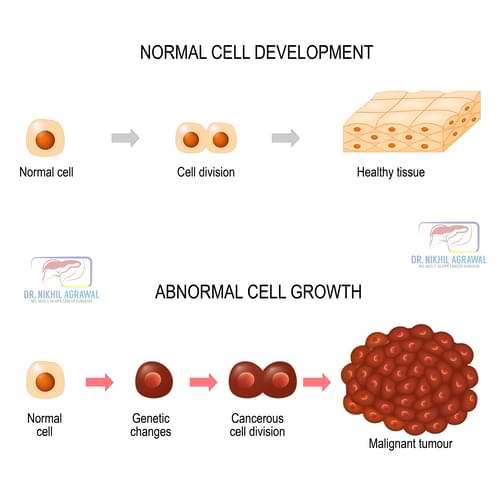 Developement of normal cell to cancer cell