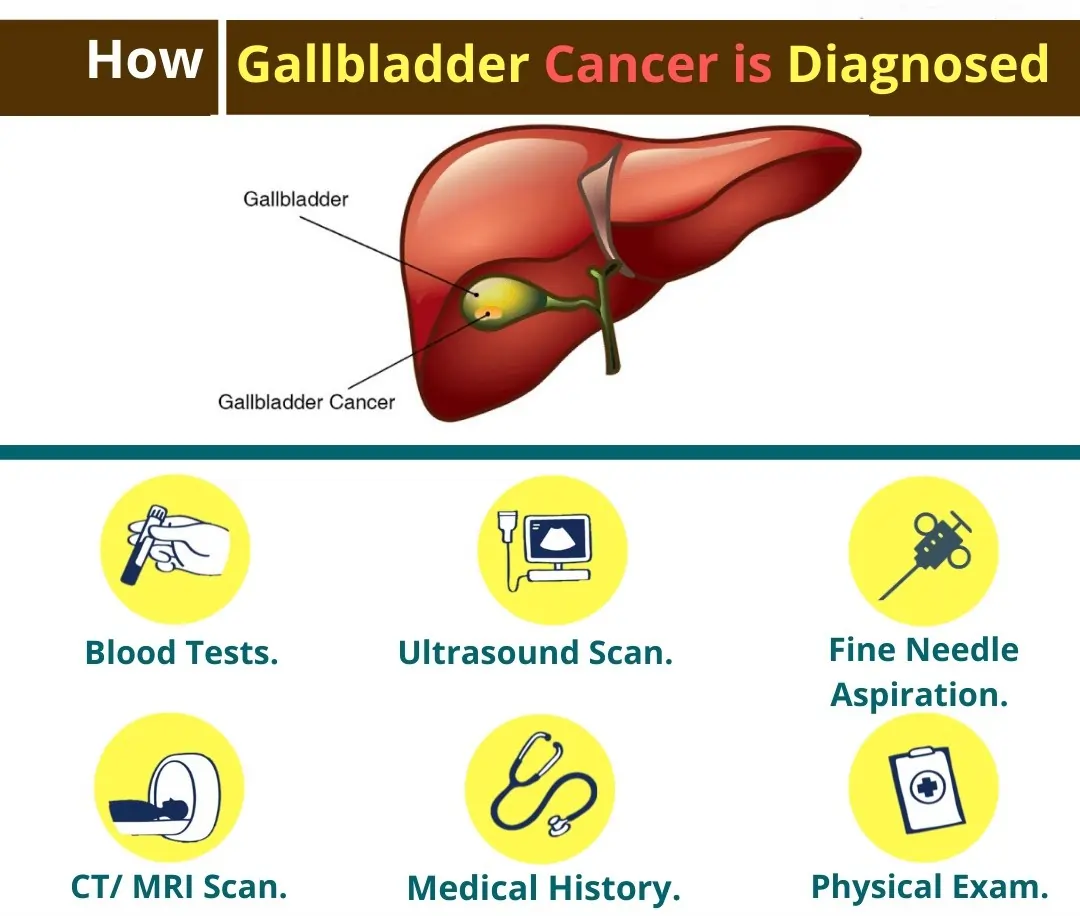 How gallbladder cancer is diagnosed?