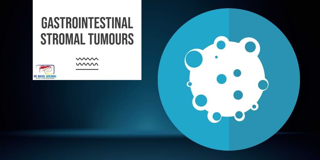 Gastrointestinal Stromal Tumor