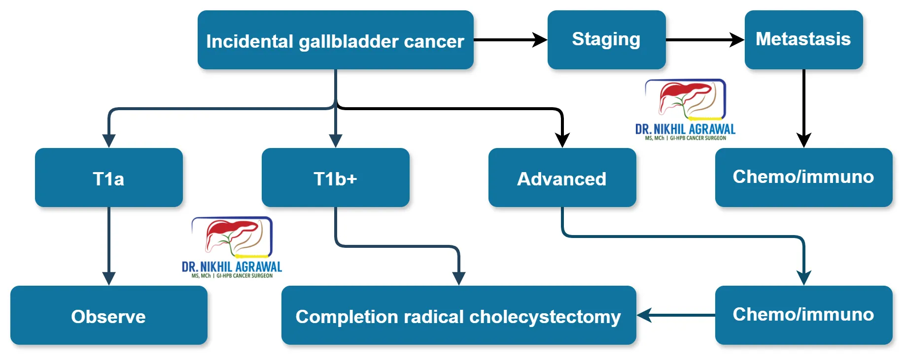 Treatment of incidental gallbladder cancer