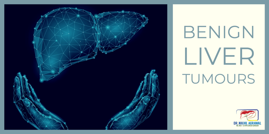 Benign liver tumours