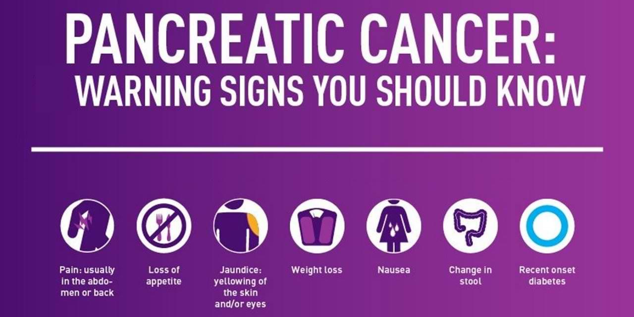What are the signs and symptoms of pancreatic cancer?