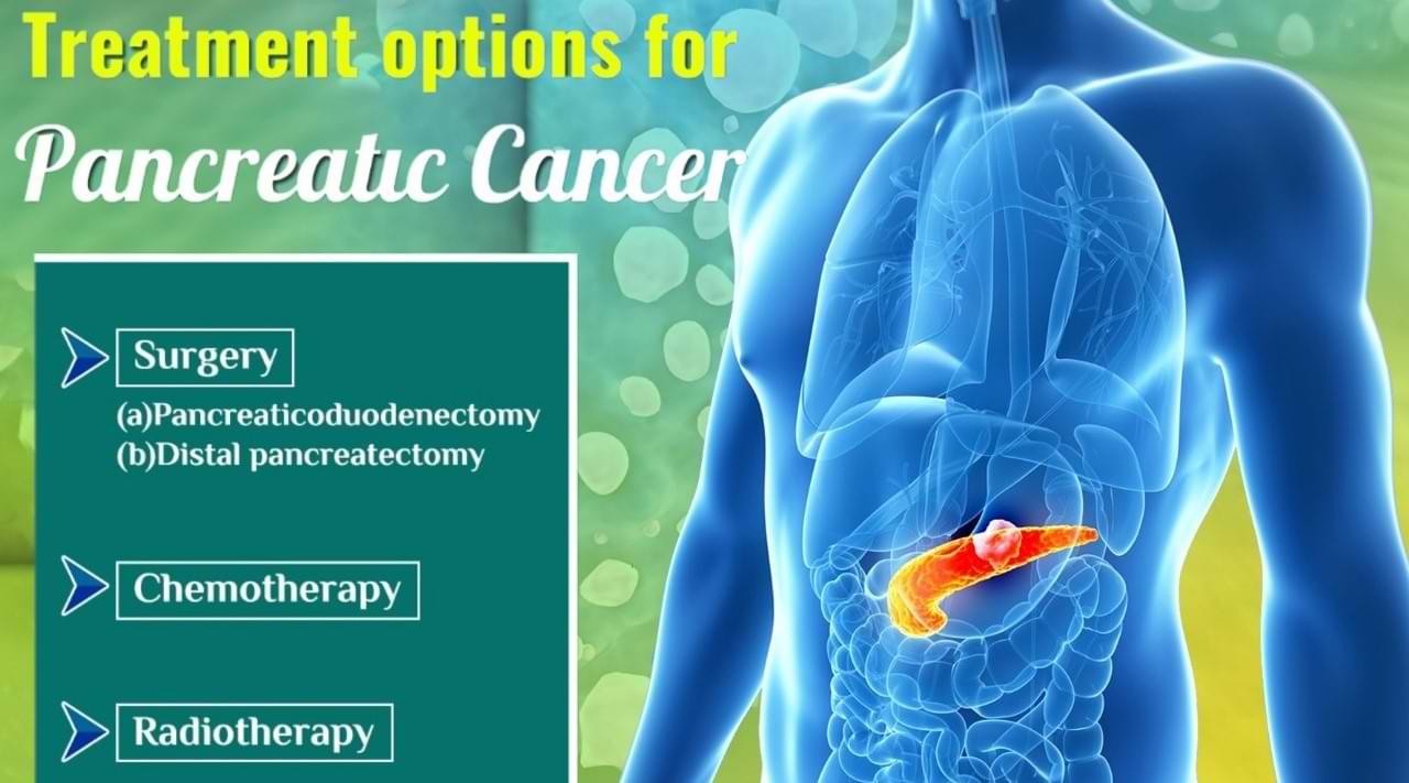 How is pancreatic cancer treated?