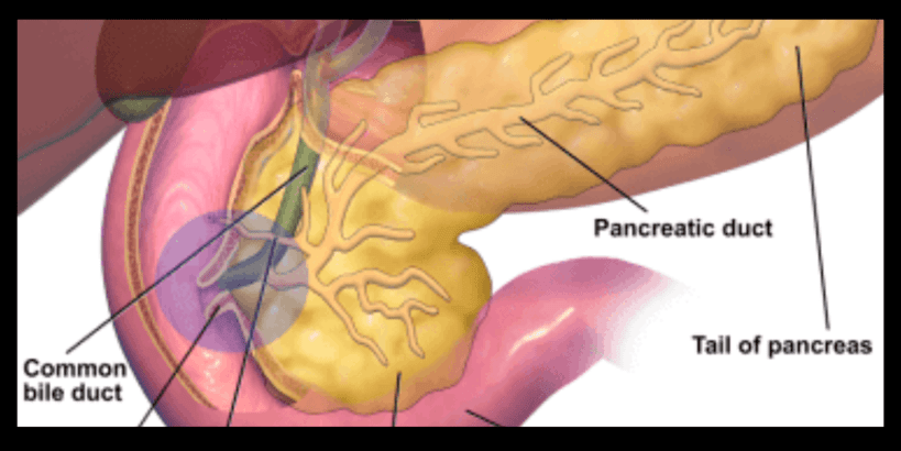 periampullary cancer