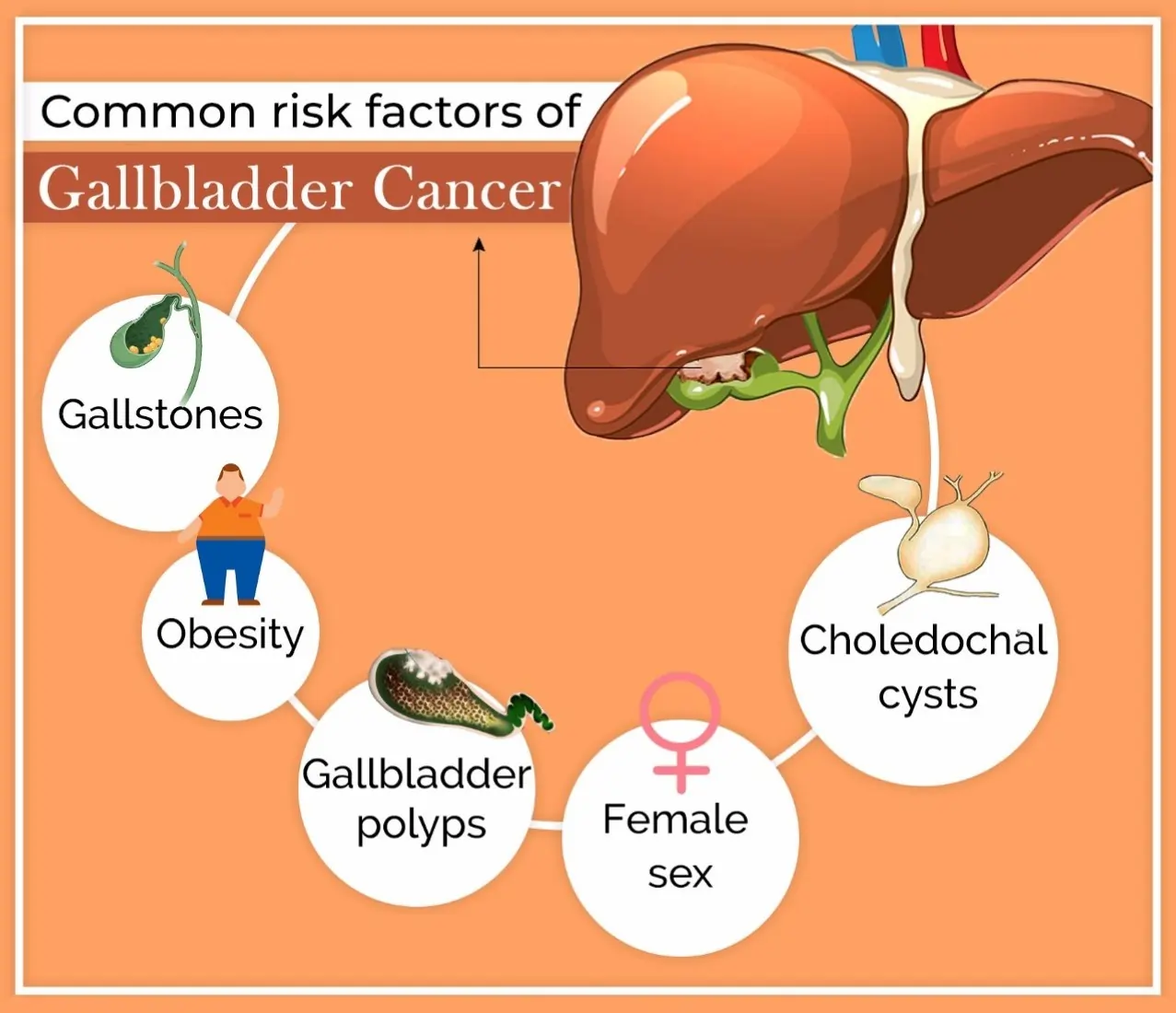 What are the causes and risk factors for gallbladder cancer?