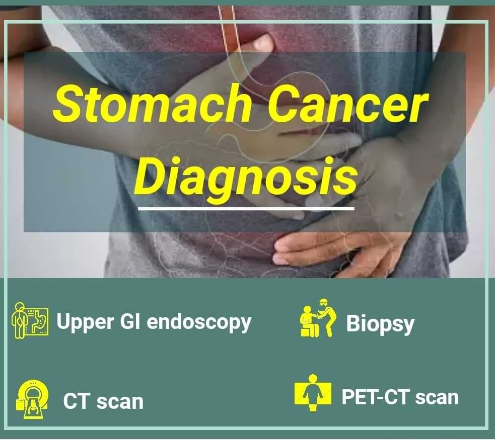 How is stomach cancer diagnosed?