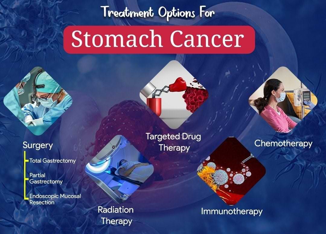 How is stomach cancer treated?