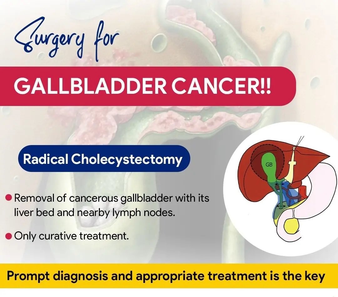Which surgery is done for gallbladder cancer?