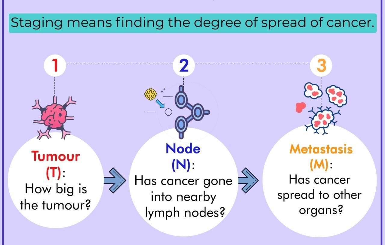 what is TNM Staging for cancer